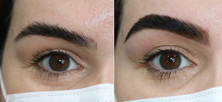 brow lamination